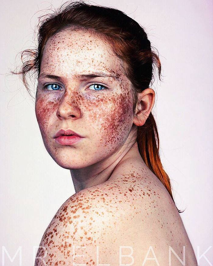 freckles-brock-elbank-striking-portraits-11