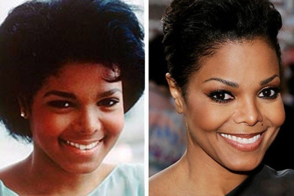 celebs_who_should_probably_stop_denying_plastic_surgery_rumors_06
