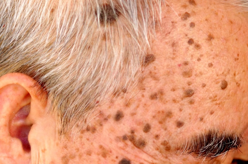 rough skin and age spots, ways your body changes after 40