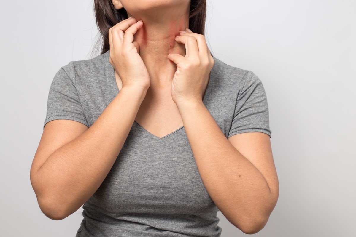 woman scratching at the skin on her neck