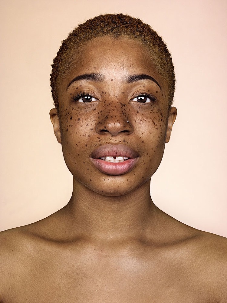 freckles-brock-elbank-striking-portraits-12
