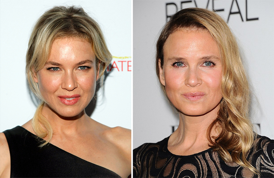 celebs_who_should_probably_stop_denying_plastic_surgery_rumors_03