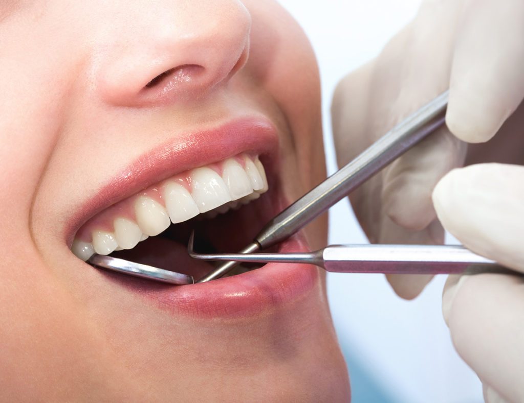 Dental checkup | 8 Self-Checks Every Woman Should Do | Her Beauty