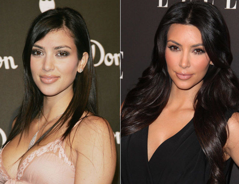 celebs_who_should_probably_stop_denying_plastic_surgery_rumors_07