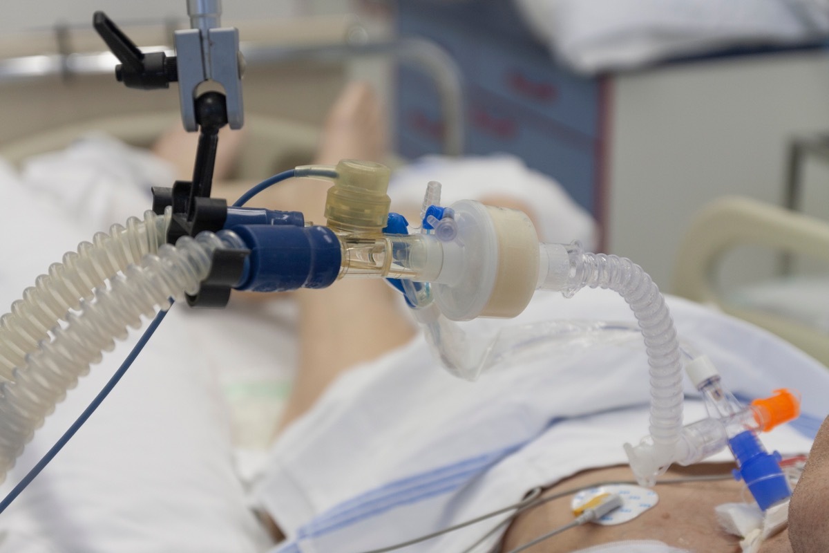 patient using ventilator in hospital