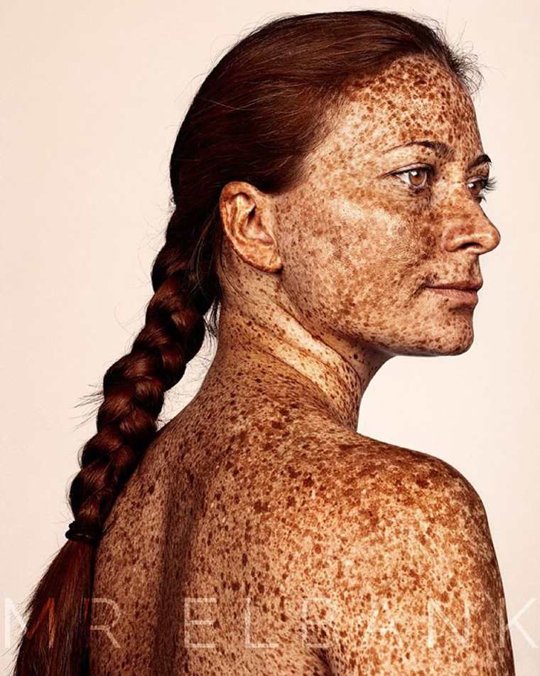 freckles-brock-elbank-striking-portraits-07
