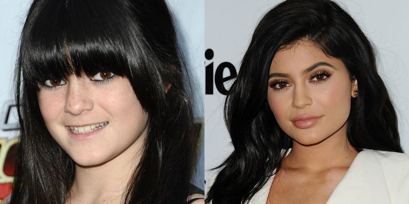 celebs_who_should_probably_stop_denying_plastic_surgery_rumors_02